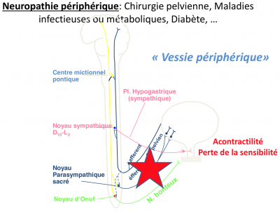 Acontractilité.png