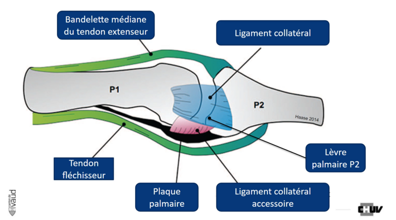 Fichier:Ligaments doigts - Wehrli CHUV.png