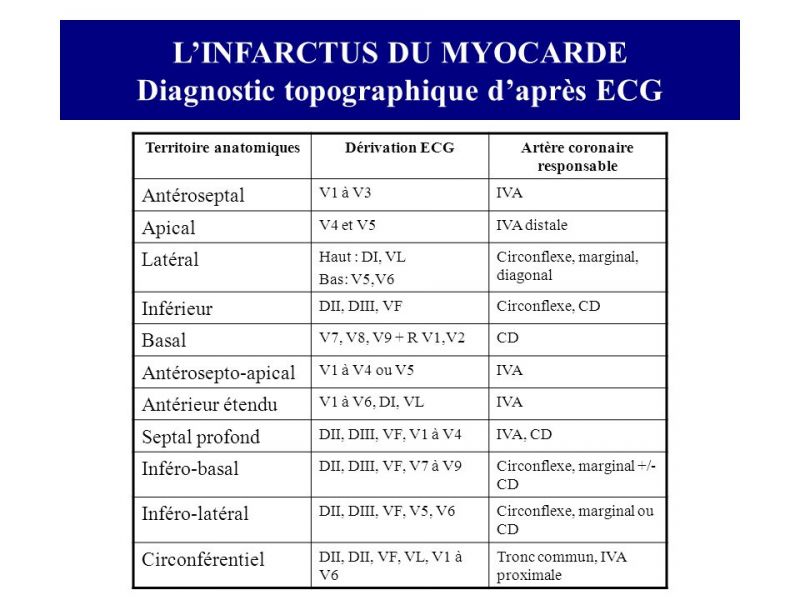 Fichier:STEMI - diagnostic topographique.jpg