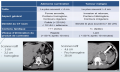 Caractéristiques radiologiques incidentalome surrénalien.png