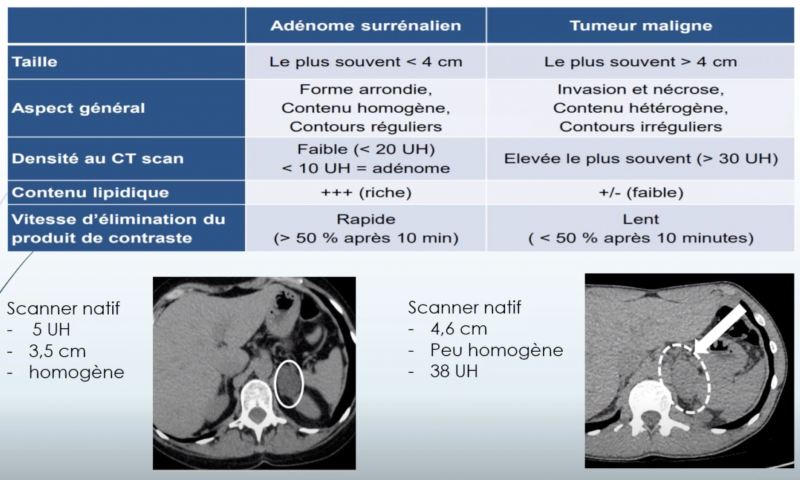 Fichier:Caractéristiques radiologiques incidentalome surrénalien.png
