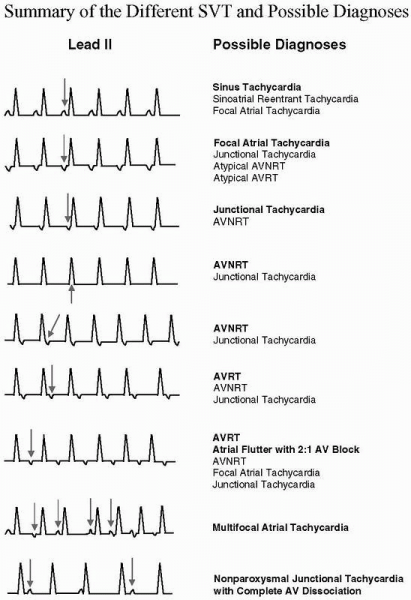 Fichier:TSV Diagnostic différentiel.png