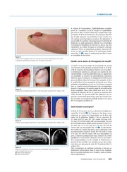 page suivante →