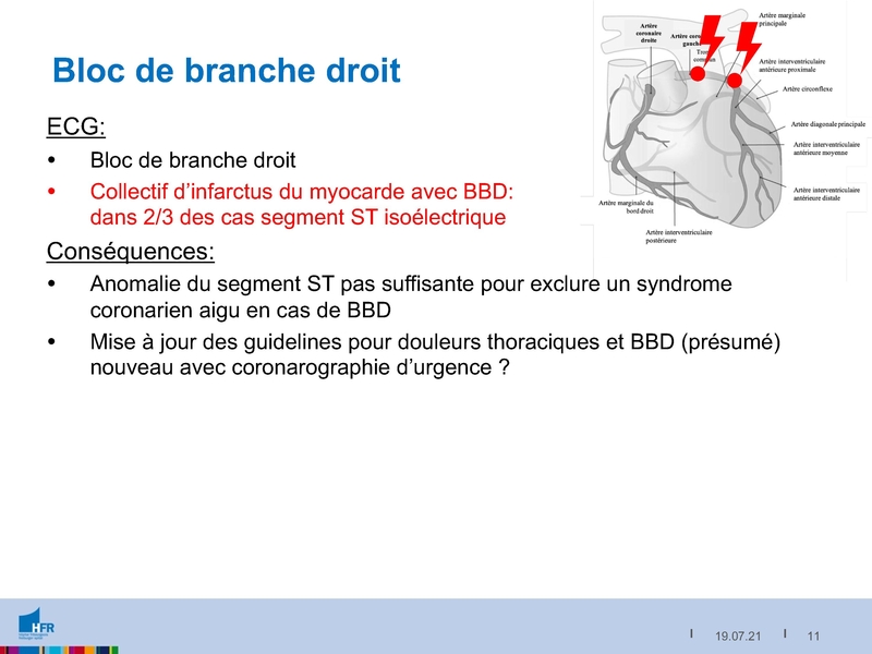 Fichier:2021-05-05 Equivalents STEMI.pdf