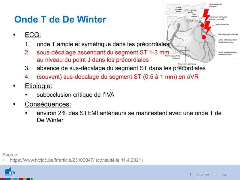 Fichier:2021-05-05 Equivalents STEMI.pdf