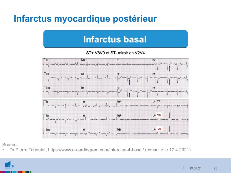 Fichier:2021-05-05 Equivalents STEMI.pdf
