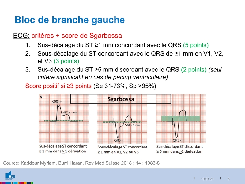Fichier:2021-05-05 Equivalents STEMI.pdf