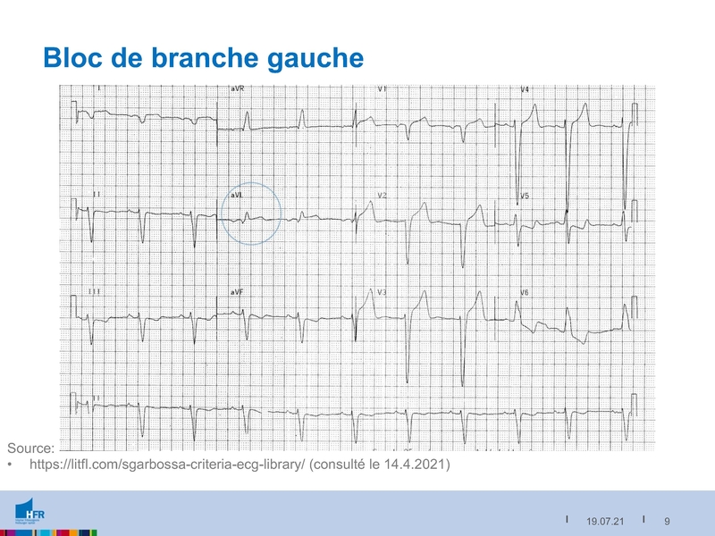 Fichier:2021-05-05 Equivalents STEMI.pdf