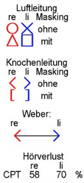 Fichier:Audiogramme conventions.png