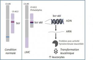 Gène de fusion bcr-abl, chromosome de Philadelphie.jpg