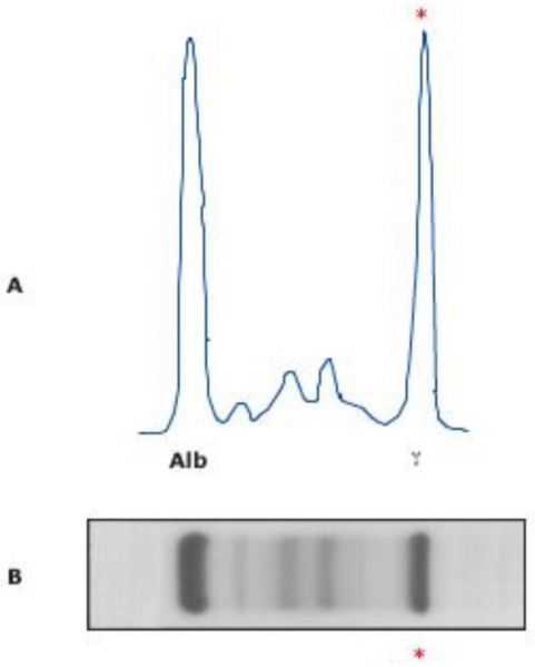 Fichier:Electrophorèse des protéines sériques.png