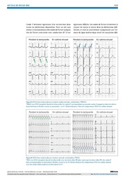 page suivante →
