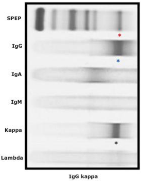 Fichier:Immunofixation des protéines sériques.png