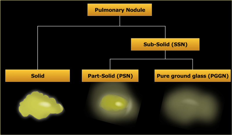 Fichier:Nodules pulmonaires classification.png
